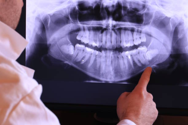 Best Emergency Dental Care for Broken or Chipped Teeth in De Soto, KS