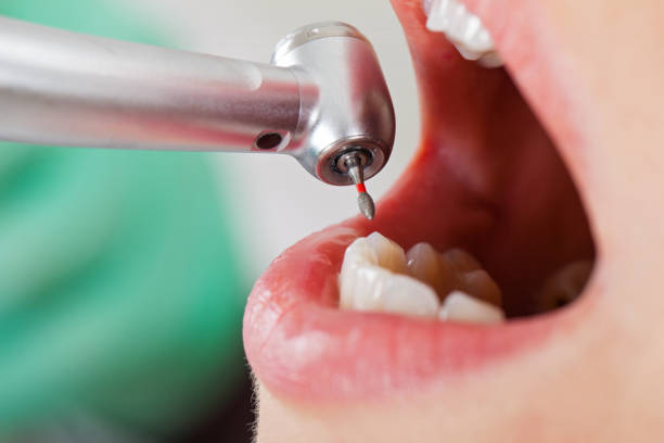 Best Emergency Tooth Extraction in De Soto, KS
